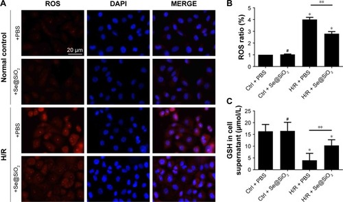 Figure 2 The level changes of ROS and GSH in HK-2 cells with different treatments.Notes: (A) Staining of HK-2 cells with ROS, DAPI. Scale bars =20 µm. (B) Changes of ROS levels in HK-2 cells after different treatments of PBS or porous Se@SiO2 nanospheres. Data were expressed as means ± SDs (n=10). #P>0.05, *P<0.05 vs Ctrl + PBS group, **P<0.05, H/R + PBS vs H/R + Se@SiO2. (C) Changes of GSH levels in HK-2 cell supernatant after different treatments of PBS or porous Se@SiO2 nanospheres. #P>0.05, *P<0.05 vs Ctrl + PBS group, **P<0.05, H/R + PBS vs H/R + Se@SiO2. Data were expressed as means ± SDs (n=3).Abbreviations: Ctrl, control; GSH, glutathione; H/R, hypoxia/reoxygenation.