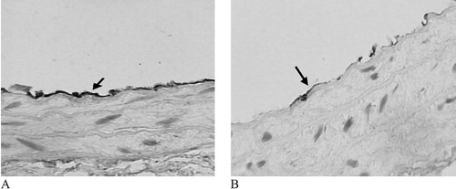 Figure 1 Effect of PZ51 on eNOS protein expression of carotid artery manifested by immunohistochemistry(×400). eNOS protein which expresses in endothelium is higher in the PZ51 group (A) than in the control group (B).