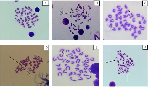 Figure 1. Some of chromosome aberrations in bone marrow cells from CD-1 male mice treated ip with vanadium(IV) or vanadium(III). A) Normal chromosome (control group), B) fragments (dose of 16.9 mg/Kg of V2O3), C) chromatid breaks (dose of 18.8 mg/Kg of V2O4), D) chromosomal breaks (dose of 8.46 mg/Kg of V2O3), E) chromatid breaks, and F) pulverizations (dose of 9.4 mg/Kg of V2O4).