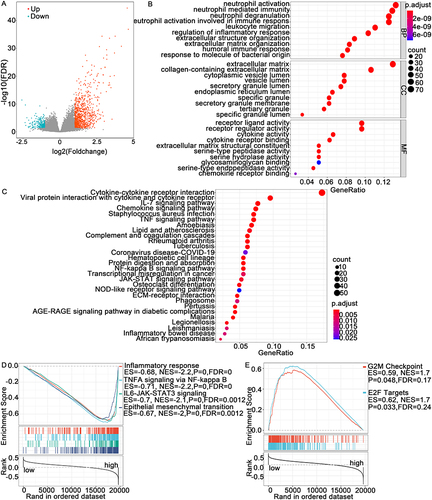 Figure 4 Differentially expressed genes (DEGs) and pathway enrichment analysis. (A) Volcano plot showing the DEGs. (B and C) Bubble chart of the results of the GO and KEGG enrichment analyses. (D and E) GSEA showed the representative signaling pathways in the high- and low-TREM-1 expression groups.