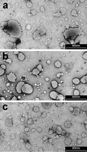 Figure 1.  Transmission electron micrographs of liposomes (batch A), transfersomes (batch D) and ethosomes (batch F; see Tables 1 and 2 for batch formulation composition).