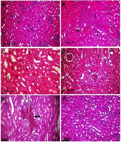 Figure 5 Histopathological alterations in the kidney tissue sections of rats in different groups. (A) Kidneys of rat in the control group showing normal glomerular and tubular histology. (B–D) Kidneys of rats in the group that received 50 mg/kg Ch-AgNPs, showing: (B) congestion, focal interstitial inflammatory cells infiltration together with degeneration and necrosis of renal tubular epithelium (arrow); (C) vacuolar degeneration in tubular epithelial cells (arrow) together with peritubular hemorrhages; (D) extensive necrosis in tubular epithelium together with hyaline cast (star) and necrotic cell debris (arrows) in tubular lumen. (E) Kidney sections of rat in the group that received 25 mg/kg Ch-AgNPs, showing severe congestion (arrow) with mild degeneration of the renal tubular epithelium. (F) Kidneys of rat in the group that received 10 mg/kg Ch-AgNPs showing normal histology.Note: All sections stained by H&E.Abbreviation: Ch-AgNPs, chitosan-coated silver nanoparticles.