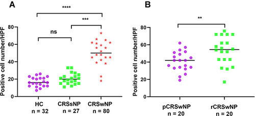 Figure 6 Quantification of B7-H4+ cells in immunofluorescence staining. (A) Compared to, the increased the number of B7-H4+ cell in the CRSwNP group was higher the CRSsNP and HC groups. (B) The B7-H4+ cell number were significantly higher in the rCRSwNP group than the pCRSwNP group. **P<0.01; ***P<0.001; ****P<0.0001.