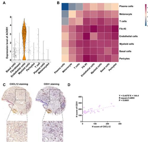 Figure 4 Chemokine enriched fibroblasts were closely related to endothelial cells. (A) Violin plot showing the expression of ACKR1 in major cell types. (B) Heatmap showing the number of potential ligand-receptor pairs among cell groups predicted by CellphoneDB v2.0. (C) CXCL12 and CD31 staining in tissue microarray of odontogenic keratocyst (OKC). (D) Stromal CXCL12 was closely related to CD31 staining in OKC (R2= 0.4853; P < 0.001). Scale bar for (C) = 200 µm.