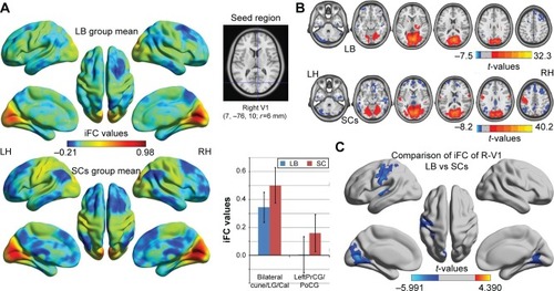 Figure 2 Significant zFC maps of right V1 differences between two groups.