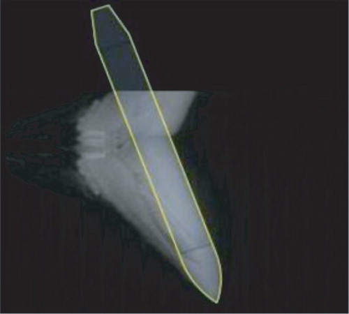 Figure 7. AUV outline selection.