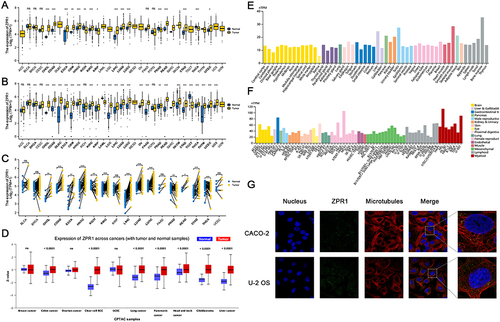 Figure 1 The ZPR1 expression in pan-cancer. (A) ZPR1 expression in pan-cancer tissues from TCGA database. (B) ZPR1 expression in pan-cancer tissues based on TCGA and GTEx databases. (C) ZPR1 expression in paired tumor and adjacent normal tissues from TCGA database. (D) ZPR1 protein expression in pan-cancer tissues from the UALCAN-CPTAC database. ZPR1 mRNA expression in various tissues (E) and cancer cell lines (F) from the HPA database. (G) Cellular localization of ZPR1 from the HPA database. *p < 0.05; **p < 0.01; and ***p < 0.001.