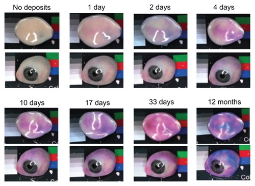 Figure 4 Photographic series showing formation of deposits on the anterior and posterior surfaces of a normally polished prosthetic eye worn continuously for the number of days indicated.