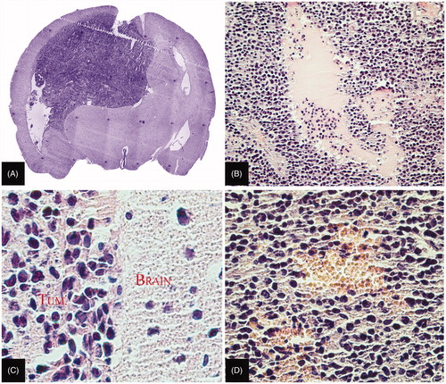 Figure 2. Histological analysis of experimental glioma 101/8. (A) General view of the glioma (×5). (B) Foci of necrosis in the central part of the glioma (×100). (C) Polymorphism of glioma cell nuclei (×400). (D) Hemorrhage in the central part of the glioma (×200). Paraffin sections stained with hematoxylin–eosin.