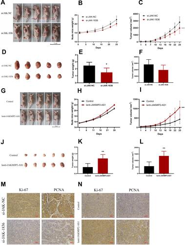 Figure 3 JAKMIP2-AS1 enhanced tumor growth in vivo. (A–F) BABL/c nude mice (4–6 weeks of age) were subcutaneously injected with HT29 cells having knockdown expression of JAKMIP2-AS1 or control.The established tumors in the left side of the ribs of the mice were measured every 5 days, and the mice were killed 25 days after implantation. (G–L) BABL/c nude mice (4–6 weeks of age) were subcutaneously injected with DLD-1 cells having stable overexpression of JAKMIP2-AS1 or control. (M and N) Protein levels of Ki-67 and PCNA in the tumor samples were determined by IHC.Original magnification 200×.Date are presented as means±standard deviation, *P˂0.05, **P˂0.01, ***P˂0.001.