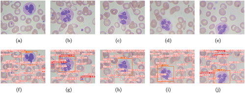 Figure 4. Visualization detection results on BCCD test set. Top to bottom: (a)–(e) Original image; (f)–(j) Detection results of the DWS-YOLO.