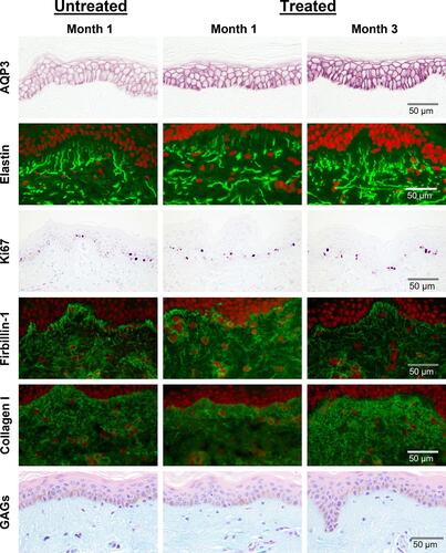 Figure 2 Histological changes 1 and 3 months after VYC-12L treatment. Representative images from histologic assessment at months 1 and 3 after treatment.