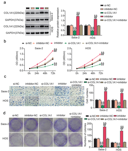 Figure 6. miR-339-3p attenuates the malignant phenotypes of osteosarcoma cells by downregulating COL1A1.