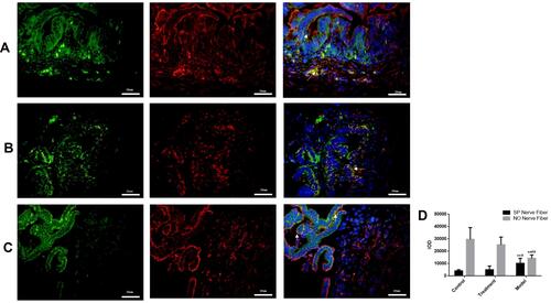 Figure 5 (A) Normal group, (B) Model group, (C) Treatment group: Rabbit SO tissue, nerve fiber in the inner muscular layer detected by laser confocal microscopy, SP and n-NOS respectively labeled SP nerve fibers (green light) and NO nerve fibers (red light) in rabbit SO tissue. The blue light is DAPI. Arrows indicate positive expression. ** indicates that the model group is compared with the control group, p<0.05, # indicates that the model group is compared with SGD group,p<0.05.In NO, ** indicates that the model group is compared with the control group, p<0.05, ## indicates that the model group is compared with SGD group, p<0.05.