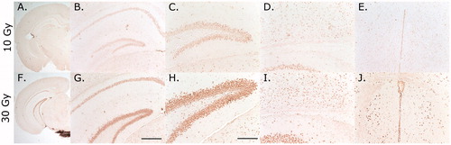 Figure 3. γ-H2AX staining results for the treatment plan shown in Figure 2. Results from the brain irradiated with 1000 cGy is shown on the top row (A–E) with 3000 cGy in the bottom row (F–J). A and F show the left hemisphere in a 1.25× magnification. B and G show the staining in hippocampus at 10× magnification. C–E and H–J show the staining at 20× magnification in dentate gyrus, cortex above the hippocampus and thalamus near the third ventricle, respectively. Scale bar in G and H indicates 400 and 200 µm, respectively.
