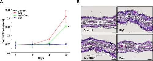 Figure 2 Dun inhibits IMQ-induced psoriasis-like inflammation of the ear skin in C57BL/6 mice. (A) Thickness of right ear skin measured on the indicated days (means ± S.D., n = 5). *p < 0.05 vs the IMQ group. (B) H&E staining of ear skin (200X).