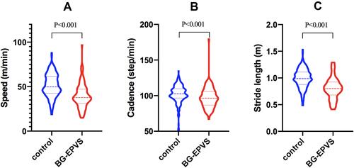 Figure 3 Violin plot of quantitative gait parameters. (A–C) Gait speed, gait cadence, and stride length of BG-EPVS group and control group, respectively.