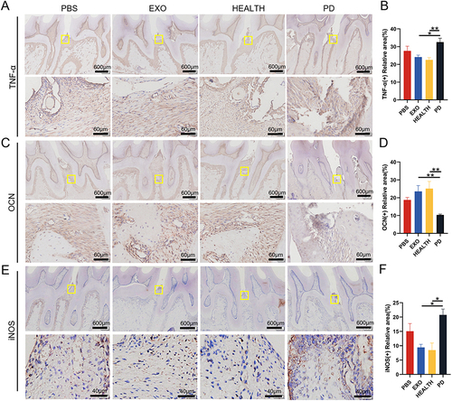 Figure 8 Immunohistochemical staining of periodontal tissue. (A and B) Inflammatory marker TNF-α staining and semi quantitative analysis. (C and D) Osteogenic marker OCN staining and semi quantitative analysis. (E and F) M1 macrophage marker iNOS staining and semi quantitative analysis. Results are the mean ± s.d. (*p < 0.05, **p < 0.01, n = 3).