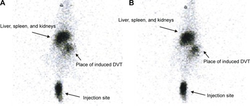 Figure 4 Whole body scintigraphy at 30 minutes (A) and at 60 minutes (B) after injection (tail vein) of 99mTc-tirofiban (3–4×105 cpm, corresponding to 2 nmol of tirofiban) to rats with induced DVT.