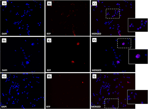 Figure 15 Fluorescent microphotographs showing the cellular location of doxorubicin (Dox) into human MDA-MB-231 cells following to free-Dox (A–C), NF-Dox (D–F) and P1+P2+P3+Dox (G–I) application. MDA-MB-231 were incubated with free- Dox (7.5 μM), NF-Dox and P1+P2+P3+Dox (50 µM, ie, 7.5 µM of Dox) for 1 h. Nuclei are shown in blue, stained with DAPI. The intrinsically fluorescence (RFP) of Dox is shown in red. Merged images derived from the overlapping of the two fluorescent emissions are. The images shown are representative of 3 independent experiments.
