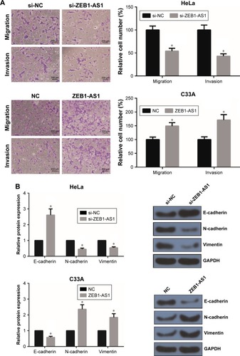 Figure 4 ZEB1-AS1 promotes CC cell invasion and EMT in vitro.