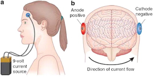 Figure 2. A simple diagram illustrating the basics of tDCS. Two electrodes, cathodal or anodal, are hooked up to a battery and placed on certain regions of the skull. Current is then applied through the electrodes to alter neural activity. Source: George and Aston-Jones (Citation2010).