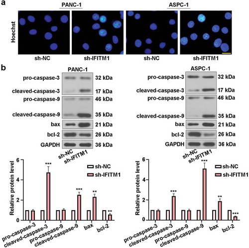 Figure 4. IFITM1 knockdown mediated cell apoptosis. (a) PANC-1 and ASPC-1 cells were transfected with sh-NC or sh-IFITM1, respectively. After transfection for 48 h, cells were stained with Hoechst and observed via a fluorescence microscope. Scale bar: 50 μm. (b) After transfection for 48 h, pro-caspase-3, cleaved-caspase-3, pro-caspase-9, cleaved-caspase-9, bax, and bcl-2 levels were detected by Western blotting in PANC-1 and ASPC-1 cells, respectively. GAPDH was used as an internal reference. Results were expressed as mean ± SD (n = 3). **p < 0.01 and ***p < 0.001 vs. sh-NC group.