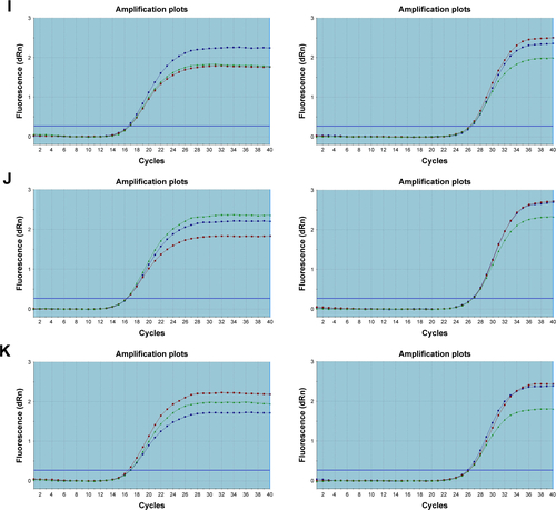 Figure S2 Amplification curves for RT-qPCR.Notes: (A) Control. (B) Lipofectamine 2000. (C) Lipofectamine 2000 + random siRNA. (D) Lipofectamine 2000 + VEGF-siRNA 1. (E) Lipofectamine 2000 + VEGF-siRNA 2. (F) Lipofectamine 2000 + VEGF-siRNA 3. (G) PLCP. (H) PLCP + random siRNA. (I) PLCP + VEGF-siRNA 1. (J) PLCP + VEGF-siRNA 2. (K) PLCP + VEGF-siRNA 3.Abbreviations: GAPDH, glyceraldehyde-3-phosphate dehydrogenase; PLCP, polycation liposome-encapsulated calcium phosphate nanoparticles; RT-qPCR, real-time quantitative polymerase chain reaction; siRNA, small interfering RNA.