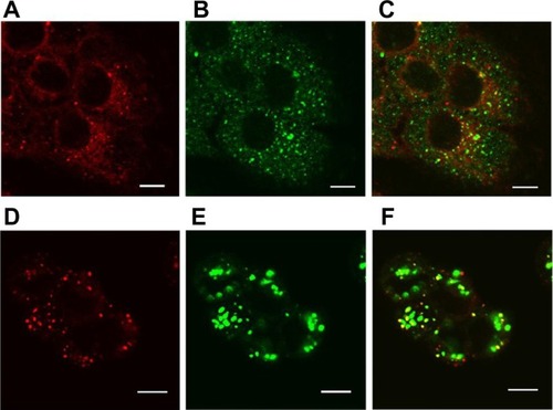 Figure 9 Localization of SV119 liposomes in DU-145 cells. Cells were incubated with rhodamine-PE labeled SV119 liposomes for 3 hours (A–C) or 16 hours (D–F) in a serum-free medium, stained with markers of early endosomes (anti-EEA1; A–C) or lysosomes (LysoTracker®; Life Technologies, Carlsbad, CA) (D–F), and imaged using confocal microscopy. Red fluorescence represents rhodamine-PE labeled liposomes (A and D), green fluorescence represents early endosomes B) or lysosomes (E). Yellow color observed in the red + green overlay (C and F) indicates colocalization of red liposomes with the green endosomes (C) or lysosomes (F).Note: Scale bar = 10 μm.