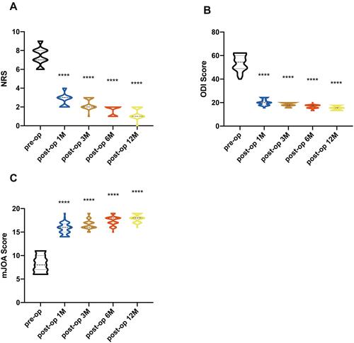 Figure 3 Violin plots of pre- and postoperative 1, 3, 6, and 12 months NRS, mJOA and ODI scores (A–C). The NRS and ODI scores at 1, 3, 6, 12 months postoperatively showed a significant decrease compared to preoperative results (P<0.01). The mJOA score at 1, 3, 6, 12 months postoperatively was significantly higher than the preoperative condition. (****p < 0.0001).