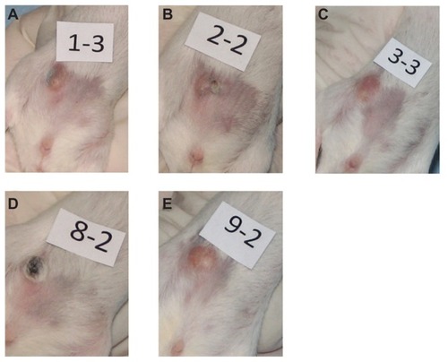 Figure 5 Digital photographs of tumors from representative mice from each group taken at 9 days of (A) multidye theranostic nanoparticle/no ablation, (B) multidye theranostic nanoparticle/one ablation, (C) control/one ablation, (D) multidye theranostic nanoparticle/four ablations, and (E) control/four ablations. There is significantly greater tumor destruction seen in the sequentially ablated tumor (D) compared to mice receiving one ablation (B) or control mice (A, C, and E).