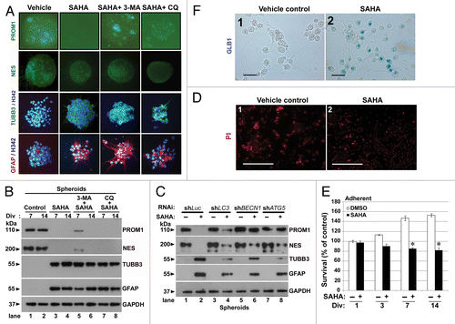 Figure 7. Reduced dose of SAHA induced differentiation in GSCs. (A) Immunofluorescence staining was performed after spheroid GSCs (PROM1 and NES, green) and adherent GSCs (TUBB3, green; GFAP, red; nuclear, blue: stained by Hoechst 33324 as nuclear counterstains) had been exposed to DMSO (vehicle), 2.5 μM SAHA alone, a combination of 5 mM 3-MA plus 2.5 μM SAHA or 25 μM CQ plus 2.5 μM SAHA for 7 d. Each square represents 200 × 200 μm. (B) Similar to the above conditions, spheroid GSCs were harvested and immunoblotting assays were performed to detect the protein levels of PROM1, NES, TUBB3 and GFAP for the 7th and 14th day. Div: days in vitro. (C) Equal amounts of spheroid GSC total cell lysates from shLuc, shLC3, shBECN1 and shATG5 GSCs (1 × 106 cells/60-mm dish) after 0 or 2.5 μM SAHA treatment for 7 d were analyzed by western blot to assess the presence of PROM1, NES, TUBB3 and GFAP. GAPDH was a loading control. (D) Adherent GSCs were treated with determination of senescence by colorimetric senescence-associated GLB1 activity assay at the 7th day in the presence or absence of SAHA (2.5 μM) induced differentiation of spheroid GSCs. Original magnification, ×400. Scale bars: 50 μm. (E) Determination of cell death using PI staining at the 7th day in the presence or absence of SAHA (2.5 μM) was not showed significant effect to affect cell death in adherent GSCs. Original magnification, ×40. Scale bars: 500 μm. (F) Using the MTT assays, SAHA-mediated cytotoxicity (2.5 μM treated for indicated time points) was analyzed in adherent GSCs. (1 × 104 cells/ well of 96-well plate). *p < 0.05 compared with control on Student t-test. Data were representative of three independent experiments with similar results. Div, days in vitro.