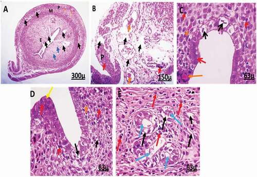 Figure 7. Photomicrographs of uterus of female rats treated with (2 mg/kg AgNps).H&E stain. P = Perimetrium, M = Myometrium, E = Endometrium.