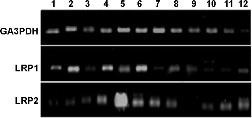 Figure S5 Agarose gel images of the Q-RT-PCR (quantitative real time polymerase chain reaction) products.Abbreviation: LRP, low-density lipoprotein receptor.
