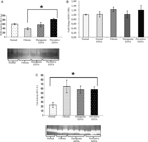 Figure 4. Activity and gene expression of superoxide-dismutase and activity of catalase. Both analyzes were realized in liver tissues of each experimental group. In graphic (A) SOD and (C) Cat activities were analyzed by zymography. Bands of antioxidant activity and their densitometric analysis are presented. The SOD and Cat activities in the normal EDTA group were not statistically different from the normal group (data not shown). EDTA treatment did not modify Cat activity, while it increased the SOD activity. Graphic (B) represents the gene expression of SOD determined by real-time PCR. Gene expression analysis was realized by real-time PCR using TaqMan probes (Applied Biosystems). The housekeeping gene 18S was used to normalize the measurement. Activities in the gel slabs from zymographies were quantified (relative units area) using an image analyzer system (Kodak 1D 3.5 image analyzer). Values are the mean ± standard deviation of the mean of five rats per group. Asterisks indicate values significantly different (*P ≤ 0.05).