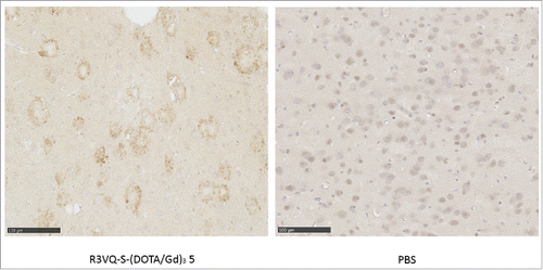 Figure 3. Immunostaining of amyloid plaques after intravenous injection of R3VQ-S-(DOTA/Gd)3 5, highlighting its ability to cross the BBB in vivo. PS2APP mice (15 month-old) were injected in the tail vein with compound 5 at 50 mg/kg (left panel, n = 3) or with PBS (right panel, n = 2), and sacrificed after 4 hours. IHC were realized with an anti-His-tag antibody. Whereas only unspecific background was observed in mice brains injected with PBS, a specific labeling of amyloid deposits was detected in those injected with 5 thus confirming the ability of the conjugate to cross the BBB after in vivo injection.