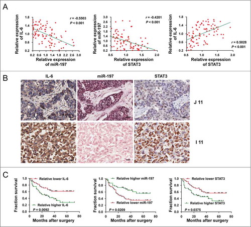 Figure 3. Correlation and prognostic significance analyses of miR-197, IL-6 and STAT3 in tissues of HCC patients. (A) A negative Spearman correlation between IL-6 and miR-197, miR-197 and STAT3 and a positive Spearman correlation between IL-6 and STAT3 were found in 90 HCC tissues. (B) Immunohistochemistry staining of STAT3, IL-6 and detection of miR-197 by ISH in two representative HCC tissues (I 11 and J 11). Scale bar = 20 μm. (C) The prognostic significance of IL-6, miR-197 and STAT3 for HCC patients assessed by Kaplan–Meier analyses.