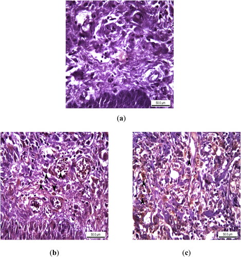 Figure 3. Immunohistochemical analysis of TNF alpha expression as an acute inflammation biomarker in rats with experimental oral mucositis and investigating the therapeutic effect of EA. (a) In the control group where experimental oral mucositis was induced, TNF alpha expression was not observed in the epithelial layer and lamina propria. Control Group, oral mucosa, Rat, IHC, Scale bar = 50 µm; (b) TNF alpha expression (marked by arrowheads) in the epithelial cells, lamina propria and intravascular inflammatory cells of rats in Group I, where experimental oral mucositis was induced after the first 5 days of EA administration. Group I, oral mucosa, Rat, IHC, Scale bar = 50 µm; (c) TNF alpha expression (marked by arrowheads) in the cytoplasm of inflammatory cells in the lamina propria of rats in Group II, who received EA for 5 days following the induction of experimental oral mucositis. Group II, oral mucosa, Rat, IHC, Scale bar = 50 µm.