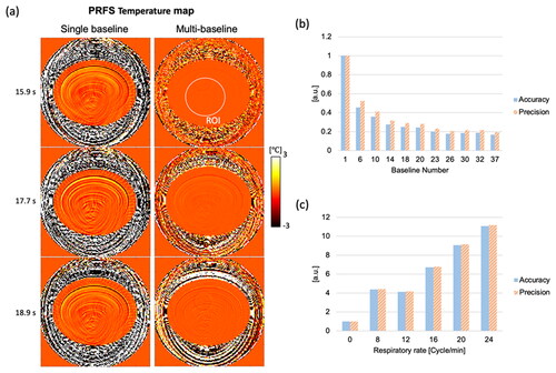 Figure 3. (a) Comparison of PRFS MR thermometry between a single baseline and multiple baselines (30 baselines) in the virtual phantom simulation. Temperature maps from multi-baseline PRFS acquisition show stable and homogeneous temperature distributions. (b,c) Bar graphs show temperature accuracy and precision according to baseline numbers and respiratory rates. In (b), respiratory rates are 12 cycles/min, and the temperature accuracy and precision in a single baseline acquisition are measured at 0.44 °C and 0.38 °C, respectively. In (c), 25 baselines are used for the PRFS reconstruction, except for no motion case (single baseline), and the temperature accuracy and precision without motion are measured at 0.0187 °C and 0.0185 °C.