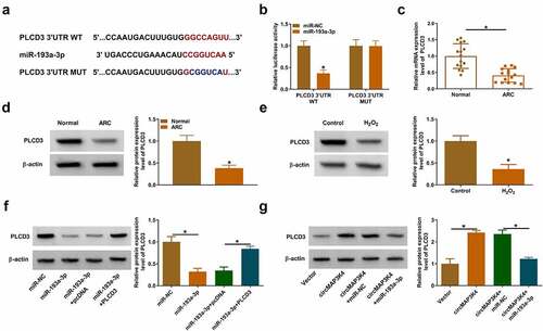 Figure 5. MiR-193a-3p interacts with the 3’UTR of PLCD3 in SRA01/04 cells. (a) Bioinformatics database starbase was used to predict the interacted mRnas of miR-193a-3p, and PLCD3 was predicted as a possible target of miR-193a-3p. (b) the target relationship between miR-193a-3p and PLCD3 was verified by dual-luciferase reporter assay. (c and d) The mRNA and protein expression of PLCD3 was determined in the lens epithelium tissues of ARC patients and normal controls (n = 15) by RT-qPCR and Western blot assay. (e) Western blot assay was performed to analyze the protein level of PLCD3 in SRA01/04 cells treated with 50 µm H2O2 for 24 h. (f) SRA01/04 cells were transfected with miR-193a-3p alone or together with PLCD3 plasmid, and the protein level of PLCD3 was determined by western blot assay. (g) SRA01/04 cells were transfected with circMAP3K4 plasmid alone or together with miR-193a-3p mimics, and the protein level of PLCD3 was examined by Western blot assay. *P < 0.05.