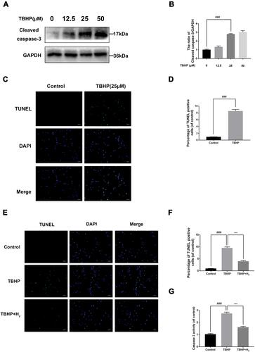 Figure 4 Effects of H2 on TBHP-induced apoptosis in human chondrocytes. The protein expression of cleaved caspase-3 in chondrocytes treated with/without TBHP was detected by Western blotting and TUNEL assay (A–D). H2 exerts the anti-apoptosis effect in TBHP-induced chondrocytes as seen from the TUNEL assay (scale bar: 50 µm) and the quantification of apoptotic positive cells (E and F). The activity of caspase-3 was determined using the caspase colorimetric assay kit (n = 3) (G). All data are presented as mean ±SEM. ###P < 0.001 vs the control group; ***P < 0.001 vs the TBHP group; n = 3.