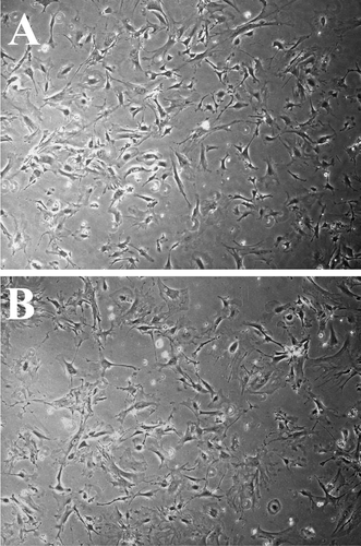 Figure 2.  Representative photographs (4× magnification) showing the cell morphology of wild-type (WT) fibroblasts (A) and Cspg2Δ3/Δ3 fibroblasts (B) at passage no. 4.