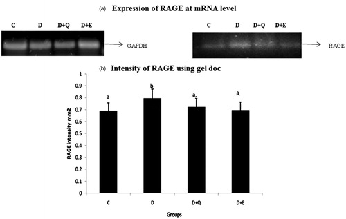 Figure 2. The relative amount of RAGE mRNA was estimated by semi-quantitative RT-PCR. The PCR products were quantified by densitometry and standardized to their respective GAPDH controls. The mean intensity was measured and expressed as INT/mm2. Results are expressed as average of quadruplicate experiments ± SD statistically significant p ≤ 0.05.