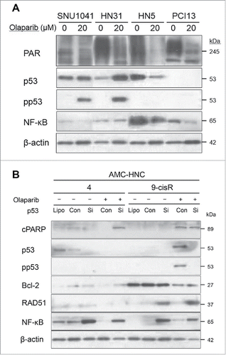 Figure 6. The p53–NF-κB interaction might induce different cell death pathways in head and neck cancer (HNC) cells after olaparib treatment. (A) Western blot analyses of SNU-1041 and HN31 (olaparib-resistant) and HN5 and PCI13 BABE (olaparib-sensitive) cells at 72 h after olaparib treatment. The basal PAR expression levels were higher in HN5 and PCI13 BABE cells than in SNU-1041 and HN31 cells, and more significant decreases in PAR expression were observed in olaparib-sensitive cells after olaparib administration. Higher basal expression levels and more significant reductions in NF-κB were also observed in olaparib-sensitive HNC cells after olaparib treatment. (B) Changes in protein expression following siRNA-mediated p53 modulation. p53 inhibition caused NF-κB overexpression in both naïve and olaparib-treated HN4 cells. In HN9-cisR cells, p53 inhibition plus olaparib treatment led to the disappearance of cleaved PARP; additionally, p53 inhibition led to NF-κB activation.