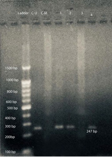 Figure 1 Gel electrophoresis of amplified products with U-P53 primers for determination of P53 methylation status. L: represents the 100-bp ladder; CU: unmethylated commercial P53 control DNA (247 bp); C-M: methylated commercial P53 control DNA; 1, 2, & 4 reveals unmethylated P53 DNA patient samples; and 3: represents methylated P53 DNA patient samples.