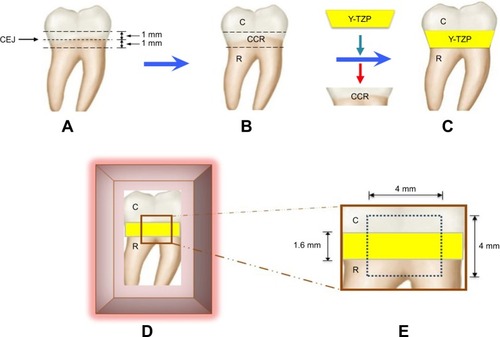 Figure 1 Human third molar (A) was sectioned at 1 mm below and above CEJ (B). The CCR portion was removed and replaced with Y-TZP disk by bonding to the C and R portion using resin cement (C), and then placed in an acrylic block (D) to create a flat surface of area 4×4 mm2 (E).Abbreviations: C, crown; CCR, crown–CEJ–root; CEJ, cemento–enamel junction; R, root; Y-TZP, yttria-stabilized tetragonal zirconia polycrystalline.