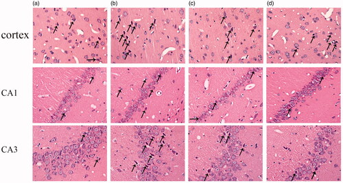 Figure 1. Protective effects of ICA against aging associated neuron damage in the cortex and hippocampus CA1 and CA3 regions of rats. After HE staining, the morphological changes of rat cortex and hippocampus was observed under an optical microscope (400×). In the cortex and CA3 region, the neurons of 6 M are normal in shape, and degeneration is rare; the neurons of 20 M have no obvious changes in density, but the degeneration neurons increased significantly. In the CA1 region, neurons are arranged tightly in adult rat, the number of cell layers is 2–3. However, the neuronal number of aging rats is reduced and the number of cell layers decreased to 1–2 layers. The arrows indicated damaged neurons.