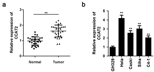 Figure 1. The expression of CCAT2 increases in cervical cancer (CC). (a) The expression of CCAT2 in the clinical samples was detected by PCR. (b) The expression of CCAT2 in CC cells was detected by qRT-PCR. **p < 0.01, compared with Normal group and GH329 group