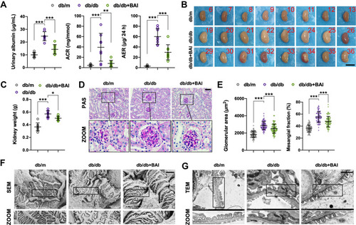 Figure 2 BAI administration reduces proteinuria and improves histopathological changes in DN. (A) The urine albumin level, urine albumin/creatinine ratio (ACR) and urine albumin excretion rate (AER) of different groups. (n=8) (B) Kidney images of different groups. Scale bar, 1 cm (n=8) (C) Kidney weight of different groups. (n=8) (D) Representative kidney PAS staining of different groups. Scale bar, 50 μm. (n=8) (E) Glomerular area and mesangial fraction of different groups. (n=8) (F) Representative kidney SEM images of different groups. Scale bar, 2 μm. (n=8) (G) Representative kidney TEM images of different groups. Scale bar, 1 μm. (n=8) All data are presented as means ± SD. *p <0.05, **p < 0.01, ***p < 0.001.