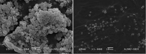 Figure 4. Electron micrographs of colonial (left) and single (right) Microcystis aeruginosa in different zoom multiples.